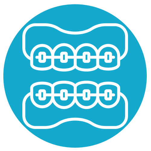 Braces