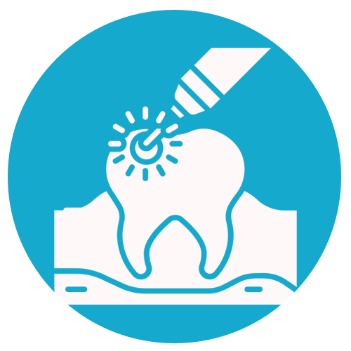 Laser Dentistry